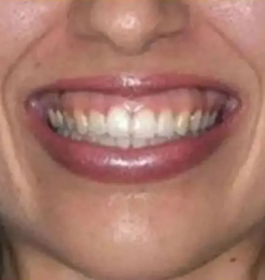 Case 01, before treatment