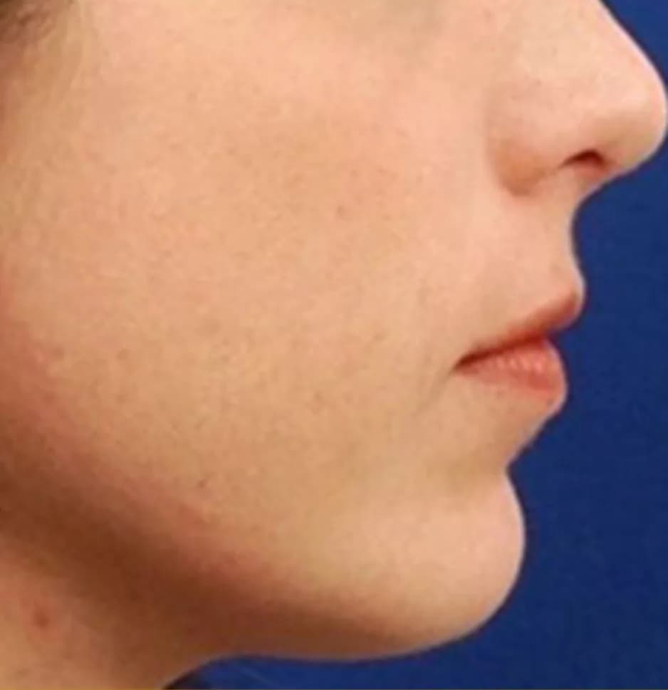 Case 02, after treatment