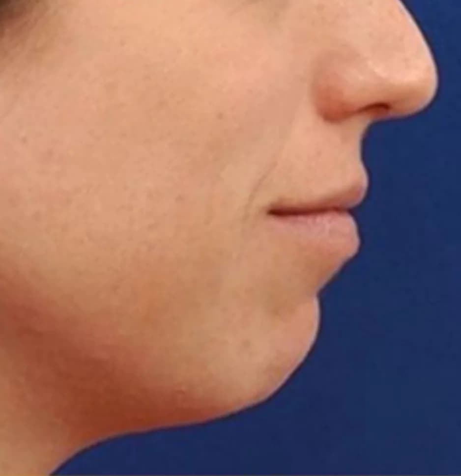Case 02, before treatment