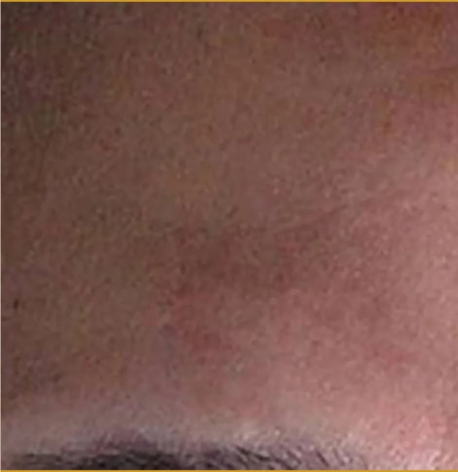 Case 03, after treatment