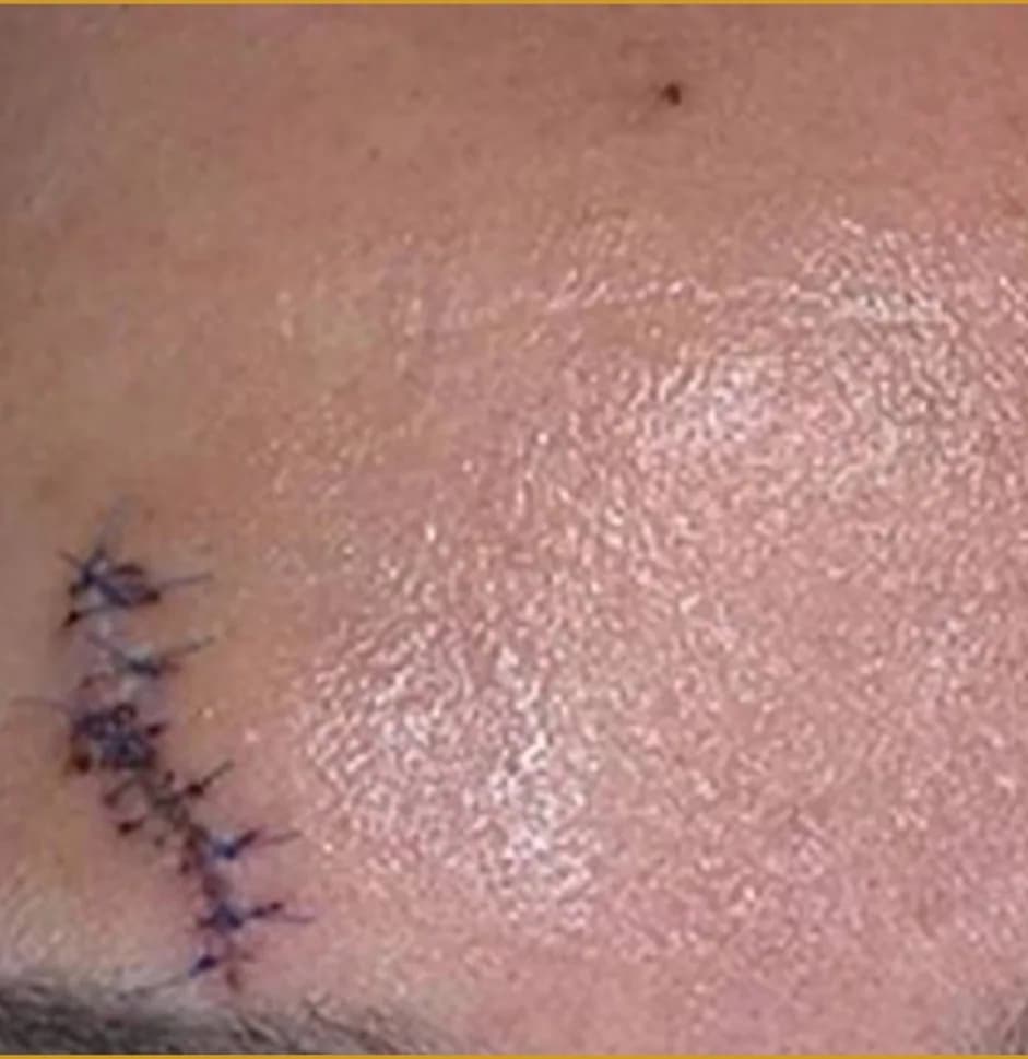 Case 03, before treatment