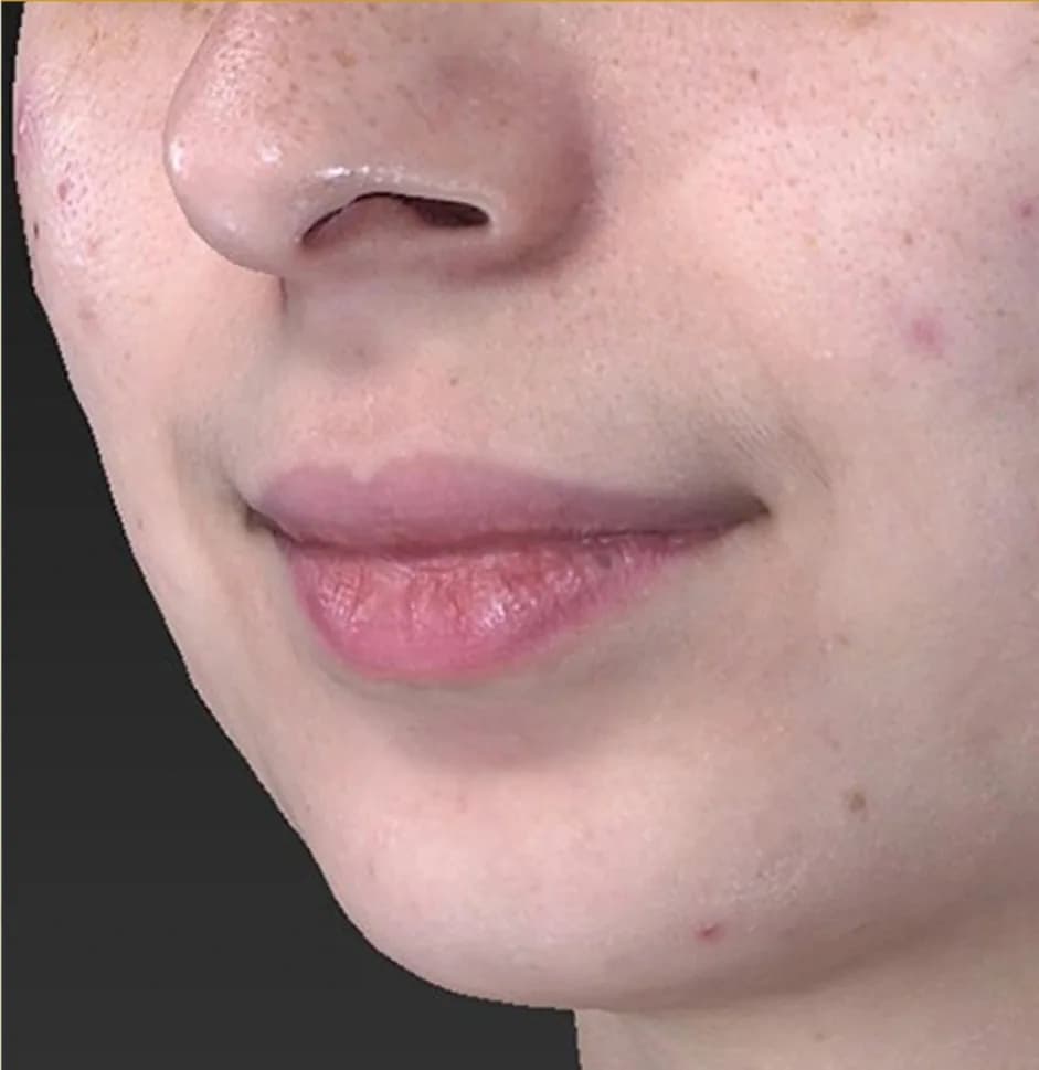 Case 04, after treatment