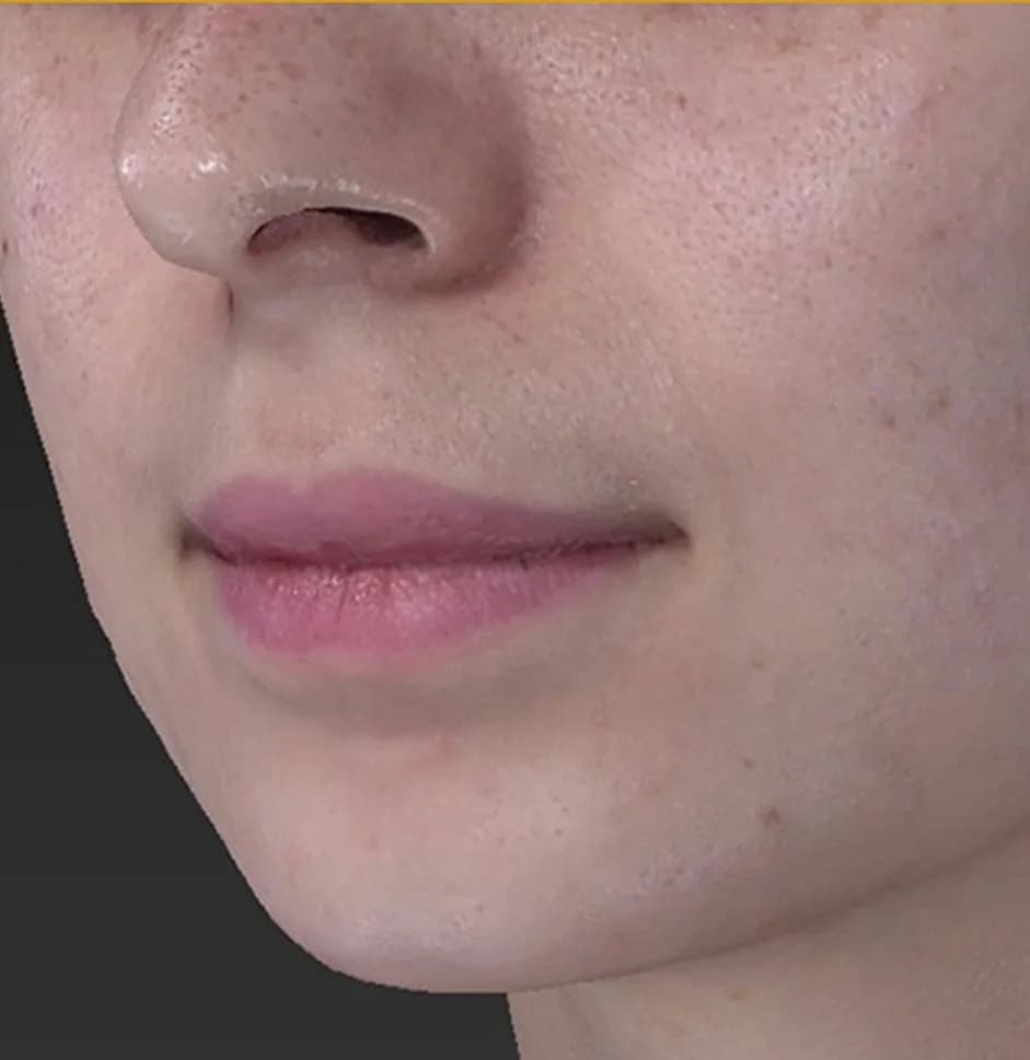 Case 04, before treatment