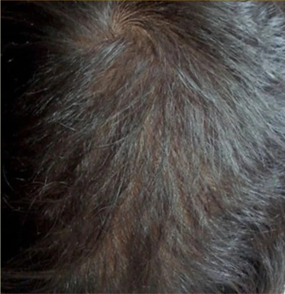 Case 07, after treatment