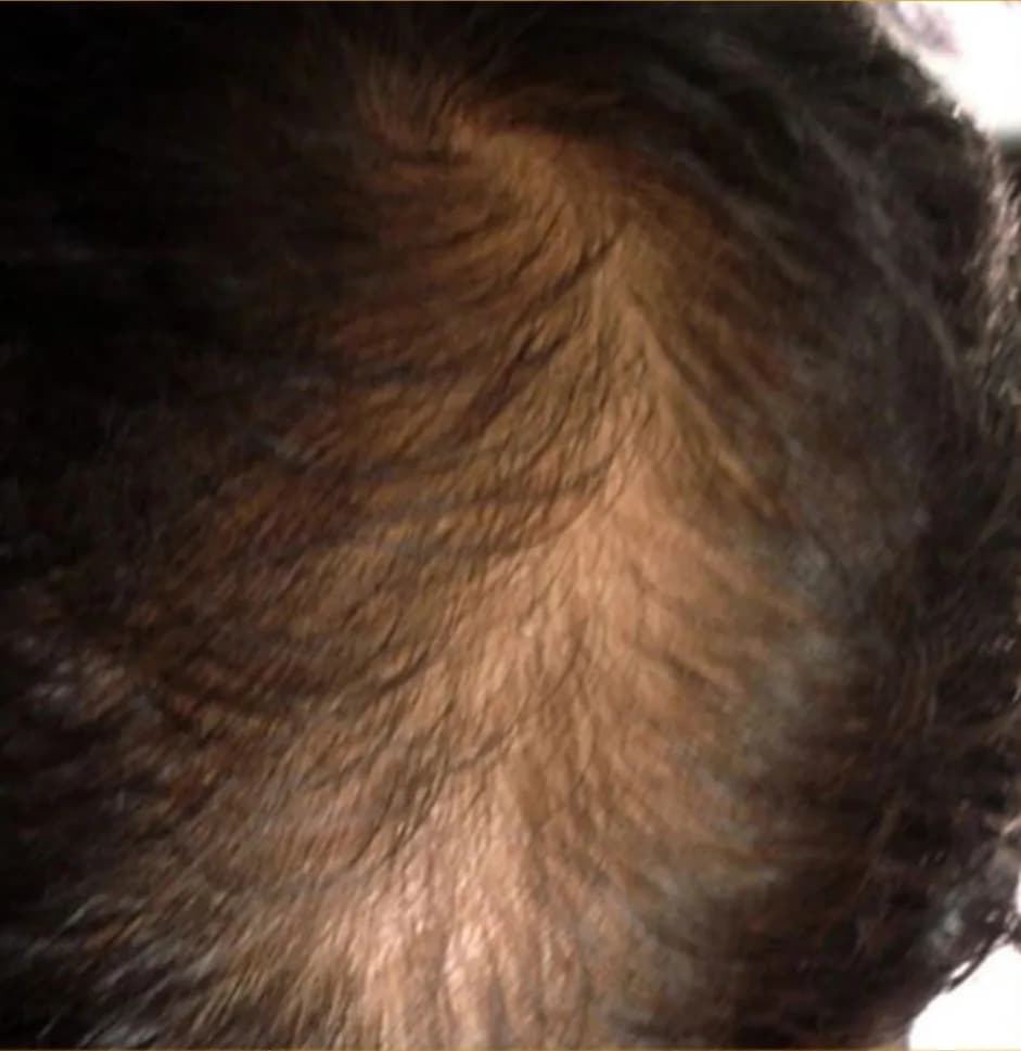 Case 07, before treatment