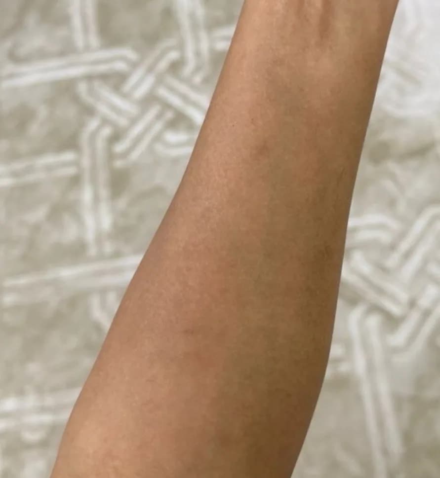 Case 08, after treatment