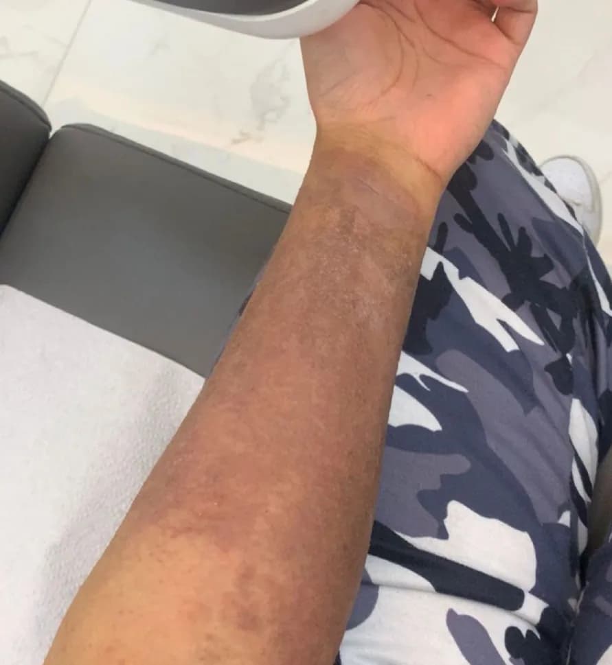 Case 08, before treatment