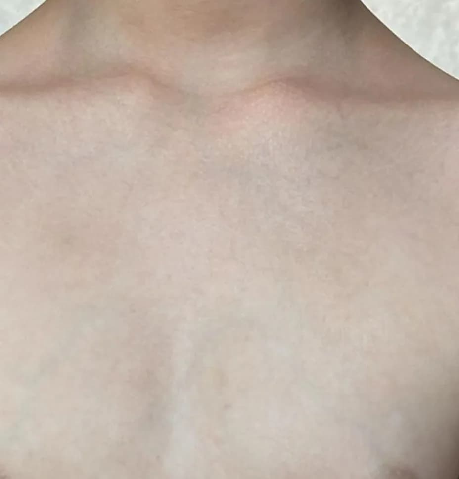 Case 09, after treatment