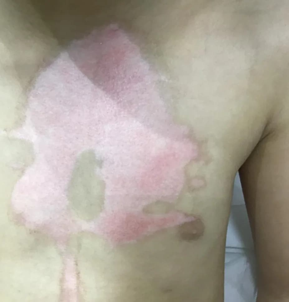 Case 09, before treatment