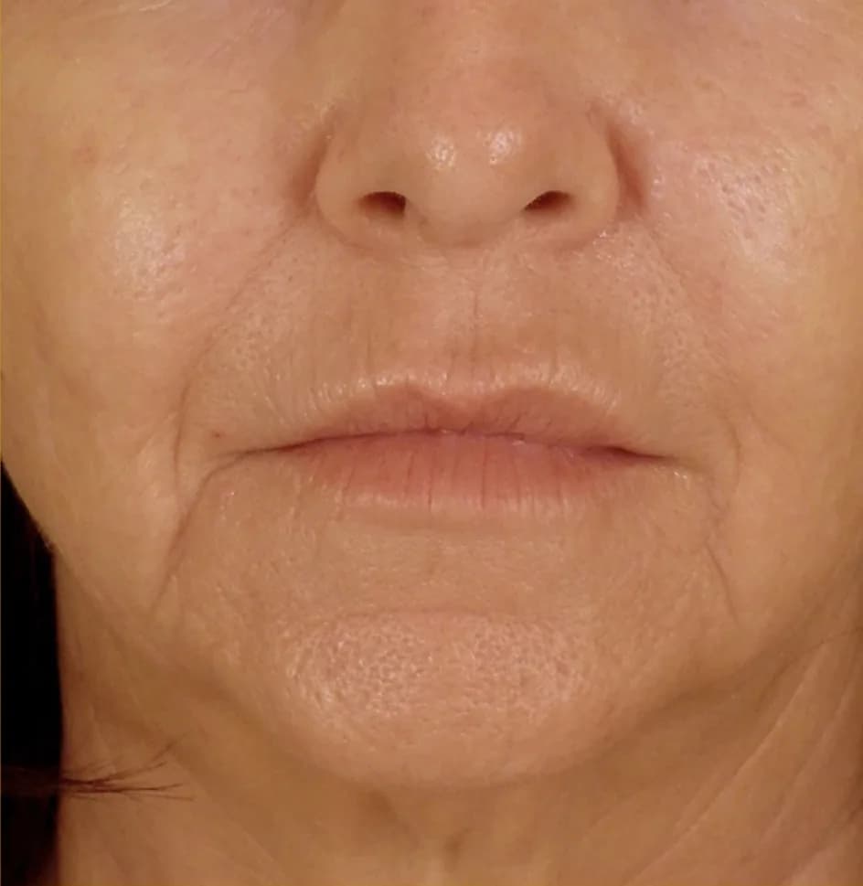 Case 10, after treatment