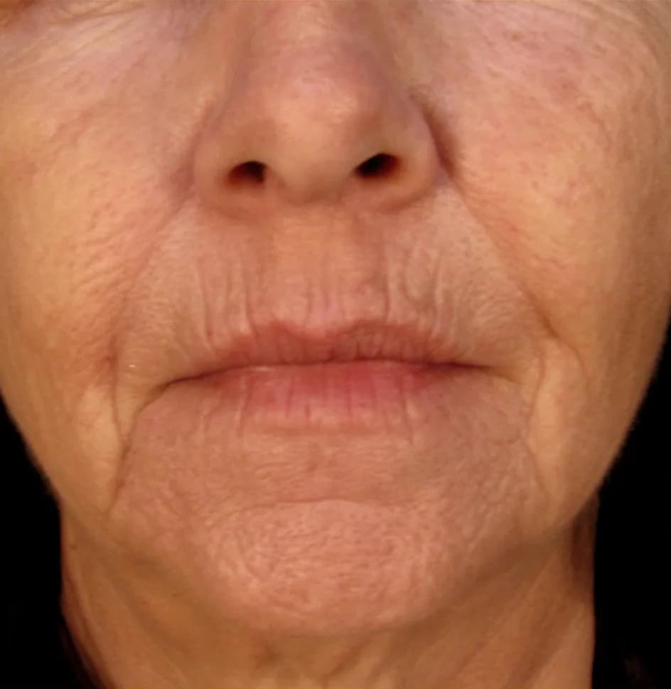 Case 10, before treatment