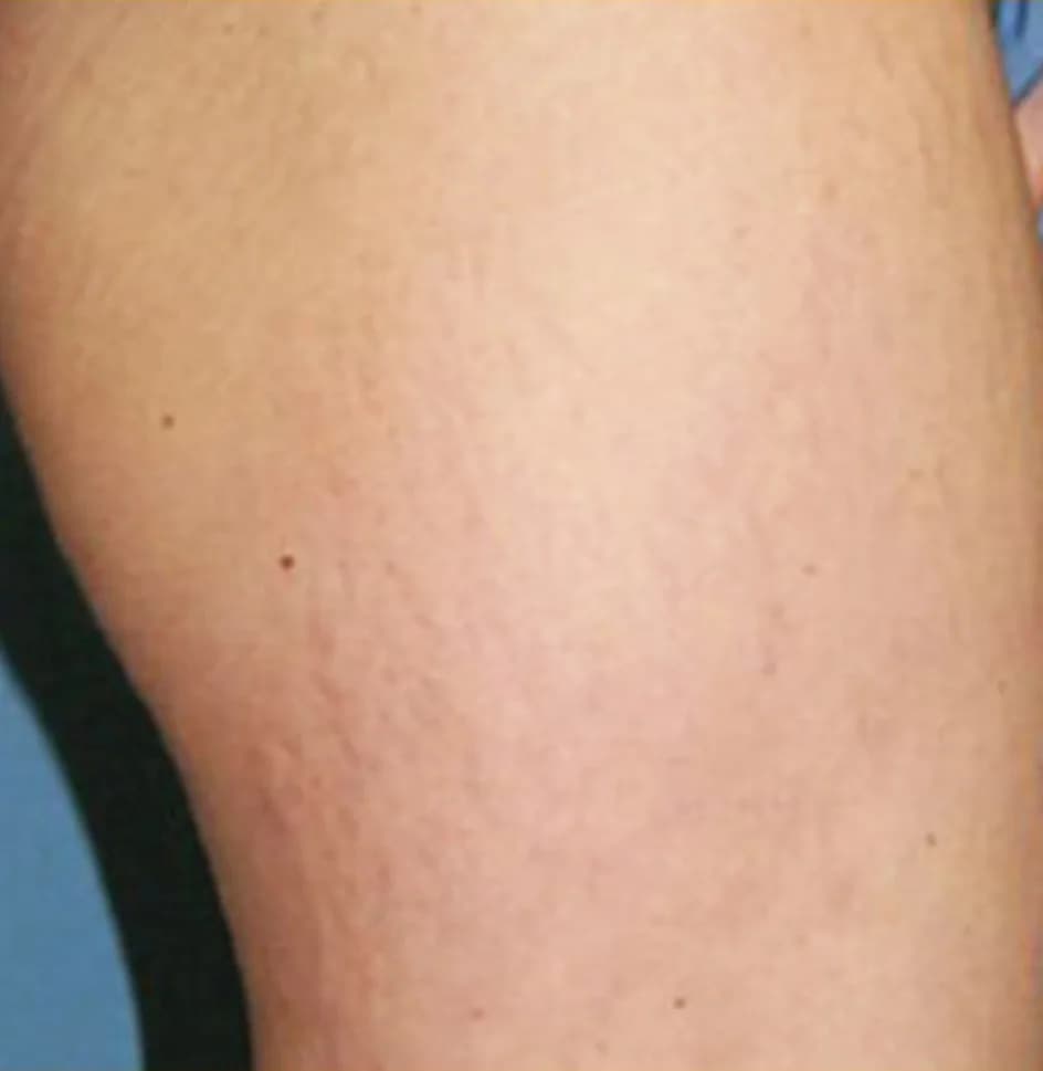 Case 11, after treatment