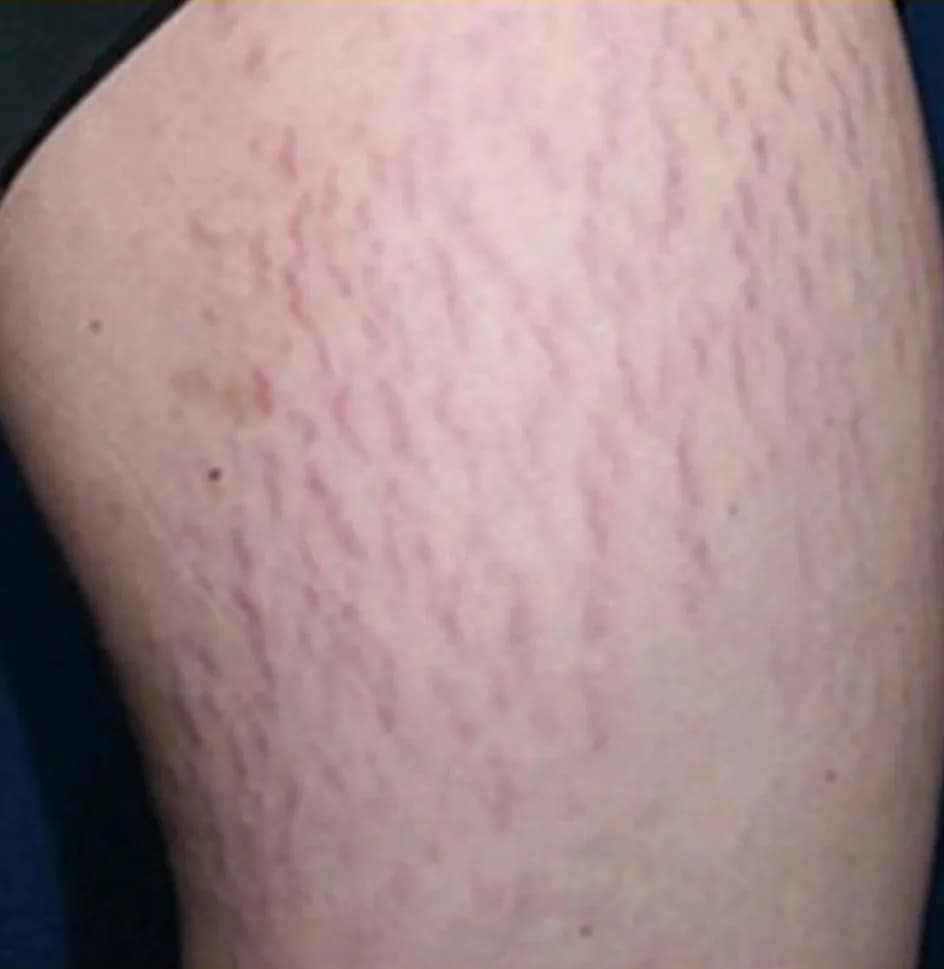 Case 11, before treatment