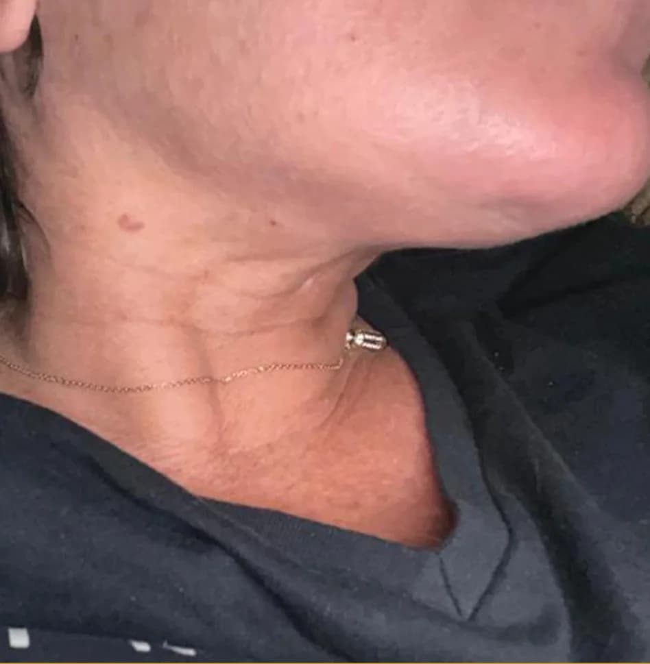 Case 12, after treatment