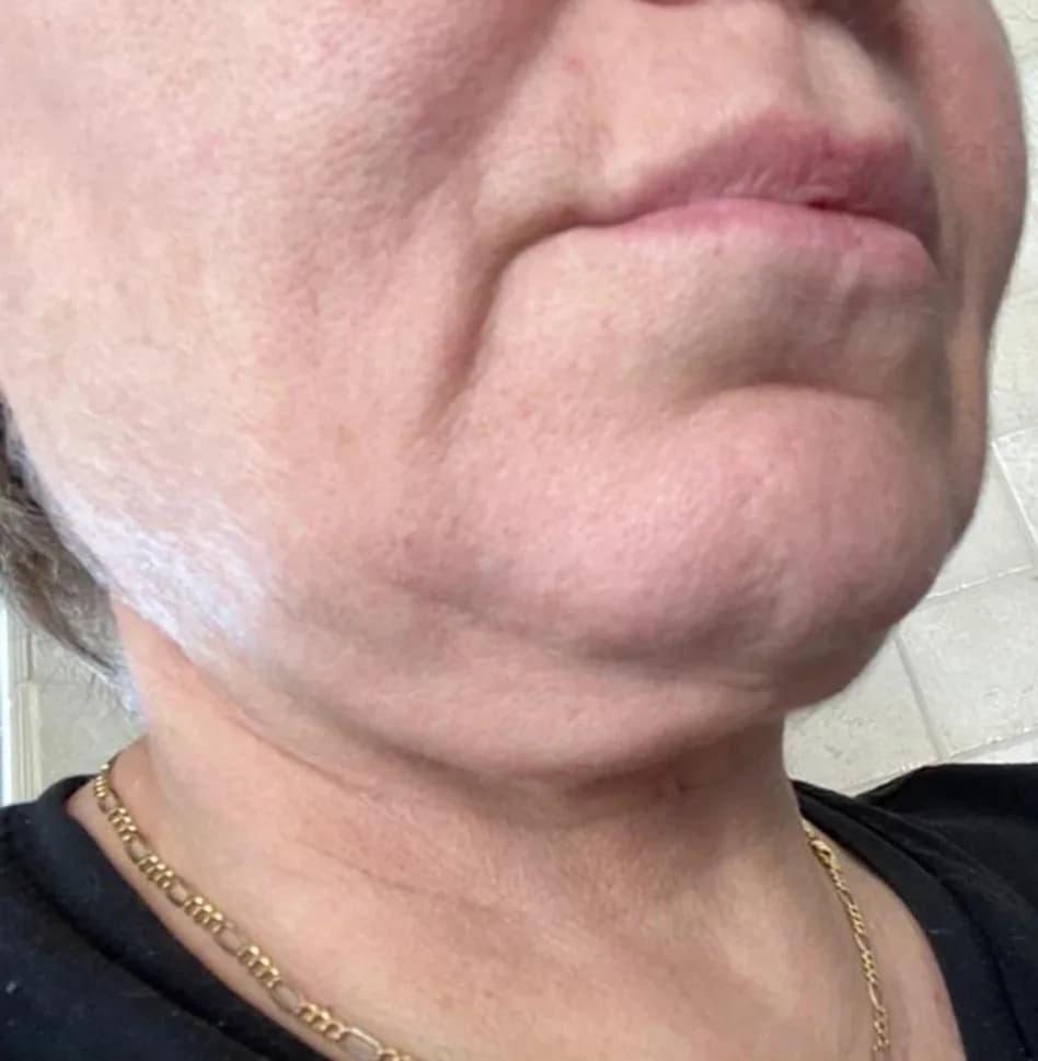Case 12, before treatment